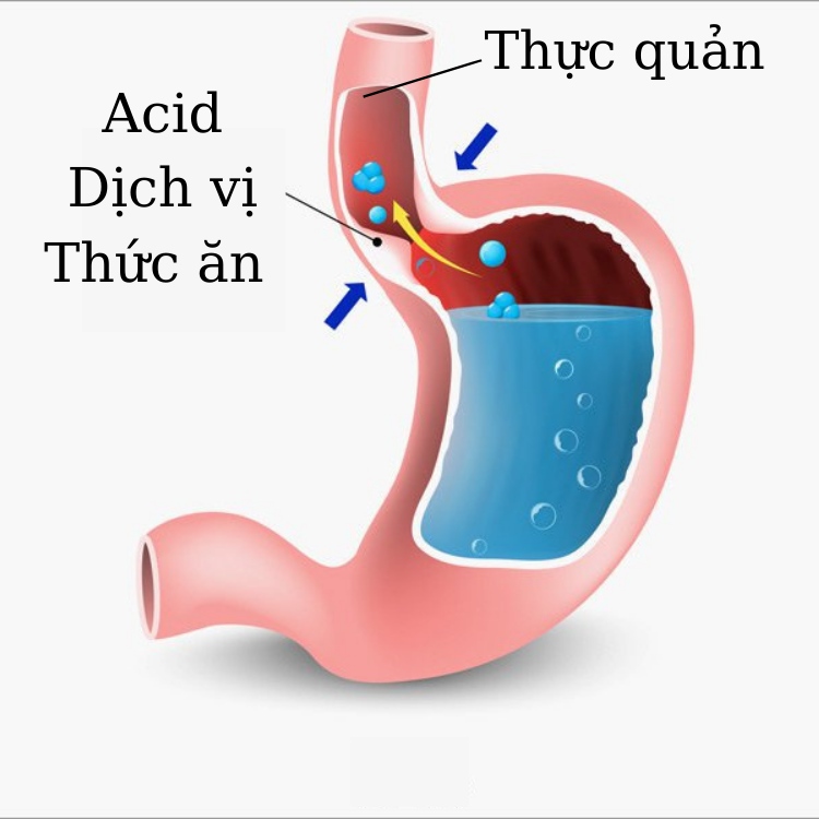 Cái kết viên mãn 1